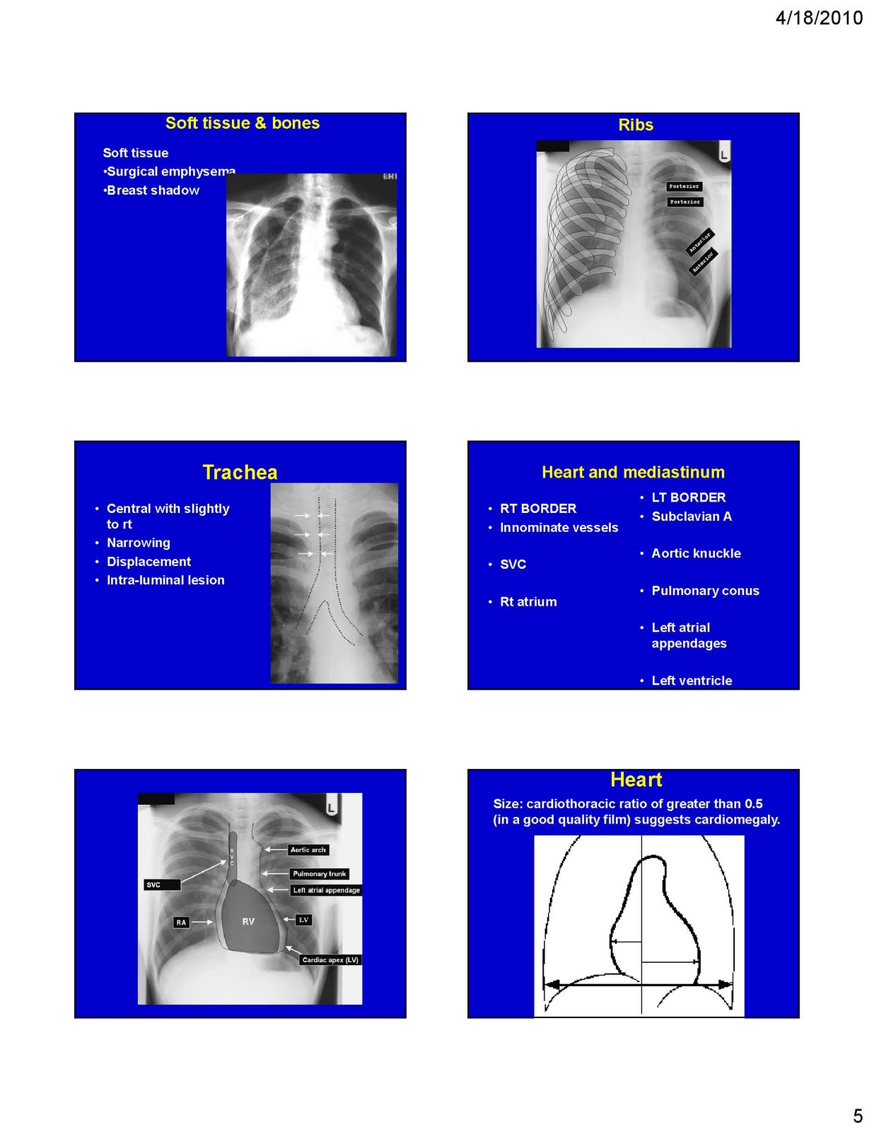 Respiratory Critical Care and Sleep Medicine CHEST XRAY